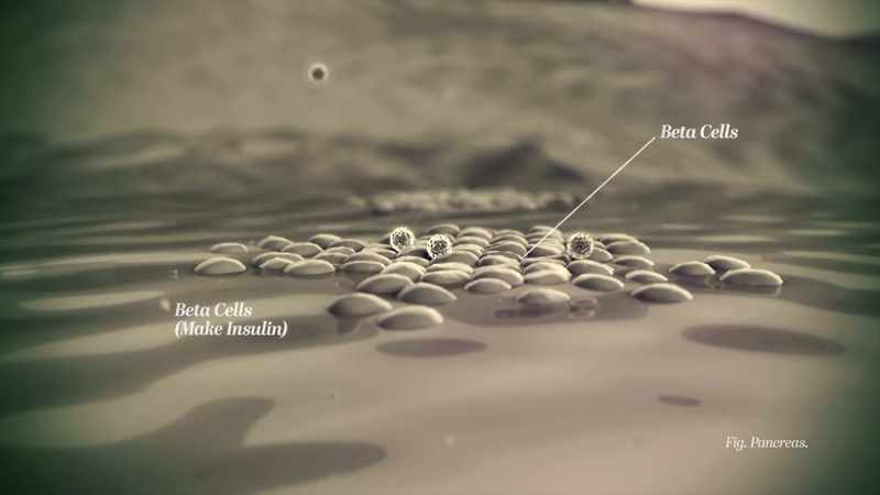 Your immune system mistakenly destroys
