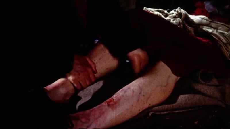 Your leg is so strange