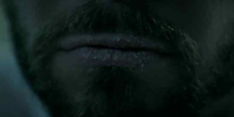 Your lips are chapped