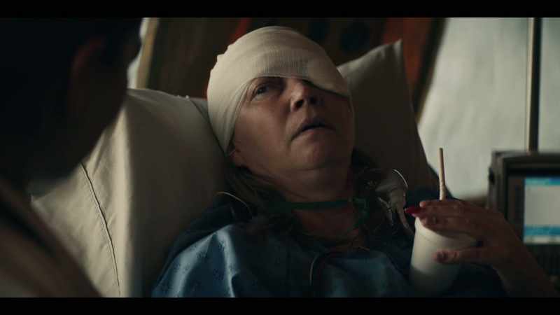 Your skull was fractured and your brain was swelling