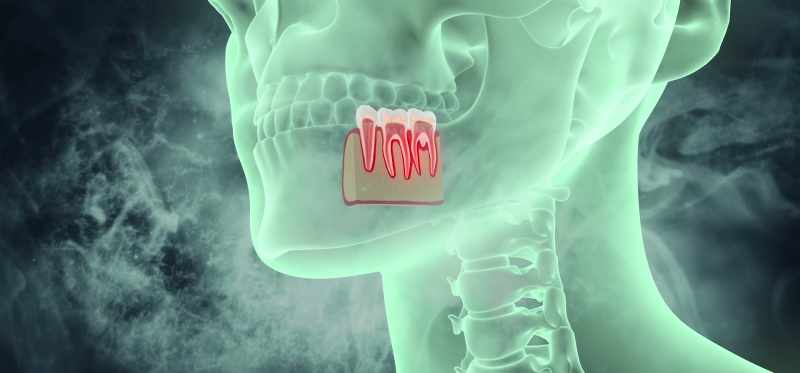 Your tooth is connected to your jawbone