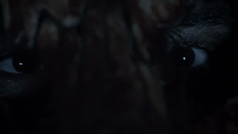 You're a werewolf!