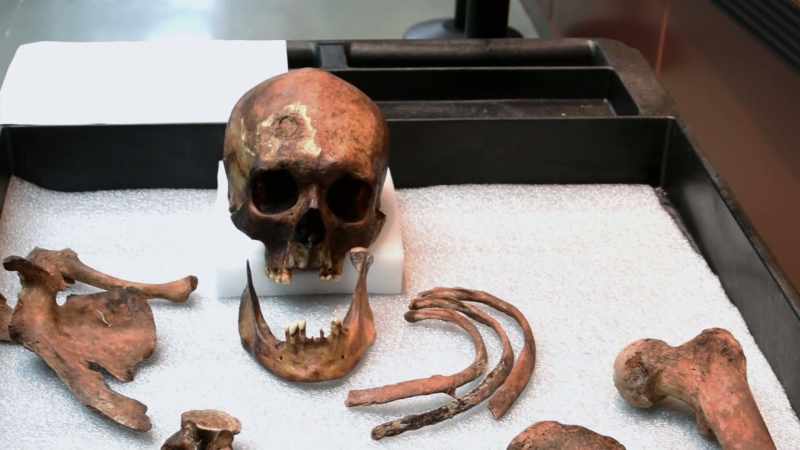 You've got a decapitated skull