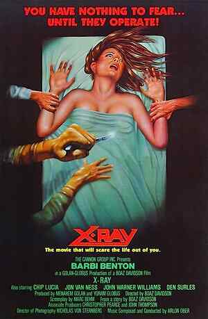 X Ray