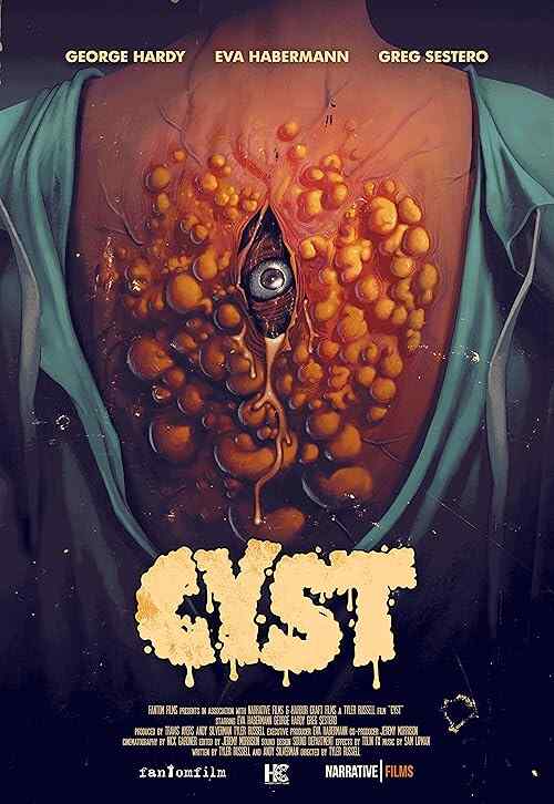 Cyst poster