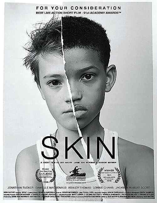 Skin poster